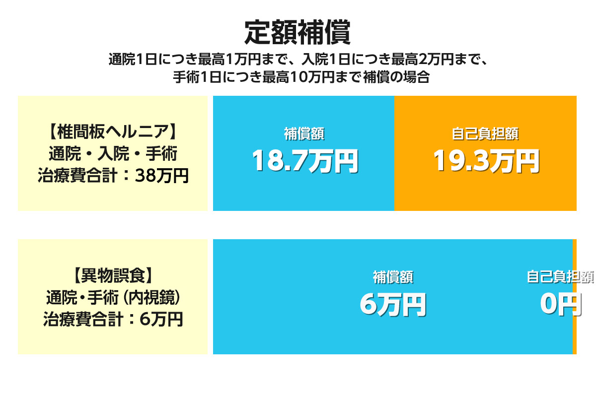 「定額補償」