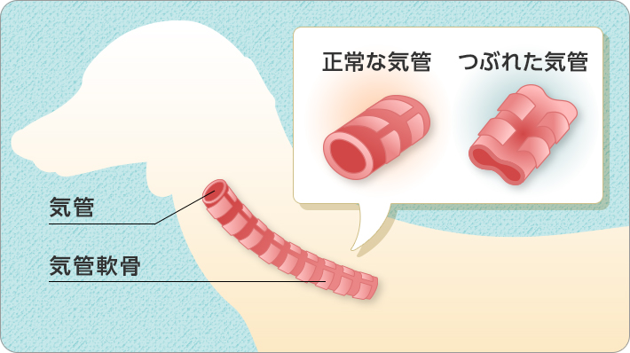 気管軟骨が歪むと気管がつぶれてしまい、呼吸が苦しくなります。